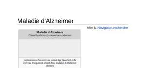 La maladie d'alzheimer 